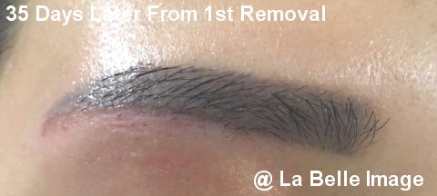 Permanent Make Up Eyebrows 35 Days Later From 1st Removal